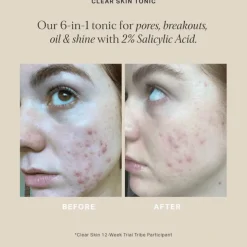 Alpha-H Clear Skin Tonic