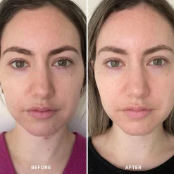 Alpha-H Vitamin B Serum with 5% Niacinamide