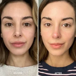 Alpha-H Vitamin C Serum with 10% Ethyl Ascorbic Acid