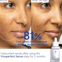 Caudalie Vinoperfect Brightening Dark Spot Serum