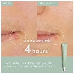 Caudalie Vinopure Salicylic Spot Solution