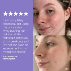 Dermalogica Ultra Calming Stablizing Repair Cream