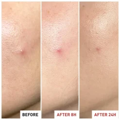 Erborian Centella SOS Patch