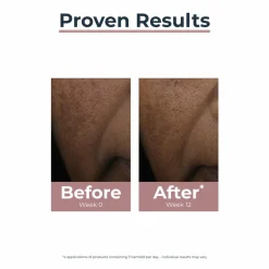 Eucerin Anti-Pigment Spot Corrector