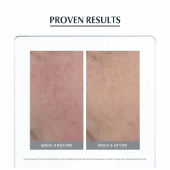 Eucerin Anti-Redness Concealing Day Cream SPF25