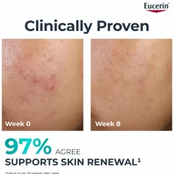 Eucerin DermoPure Overnight Peeling Treatment