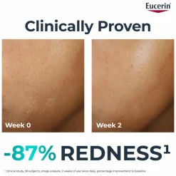 Eucerin DermoPURIFYER Adjunctive Soothing Cream