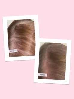 Hair Gain Scalp Foam