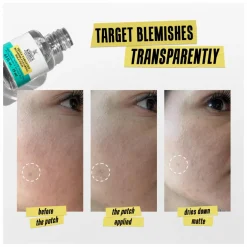 Kiehl's Truly Targeted Blemish-Clearing Solution