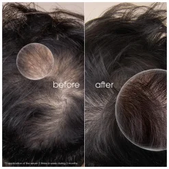 Klorane Quinine Hair Strengthening Serum