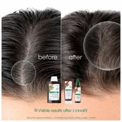 Klorane Quinine Shampoo for Thinning Hair