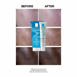 La Roche-Posay Effaclar Duo +M