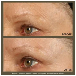 Origins Plantscription Active Wrinkle Correction Serum