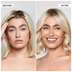 Philip Kingsley Flaky/Itchy Scalp Anti-Dandruff Scalp Toner