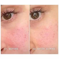 REN Evercalm Redness Relief Serum