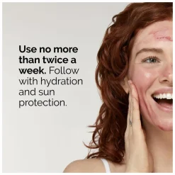 The Ordinary AHA 30% + BHA 2% Peeling Solution