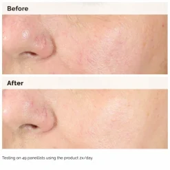 The Ordinary Alpha Arbutin 2% + HA