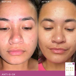 Vida Glow Anti-G-Ox Sachets - Berry Flavour